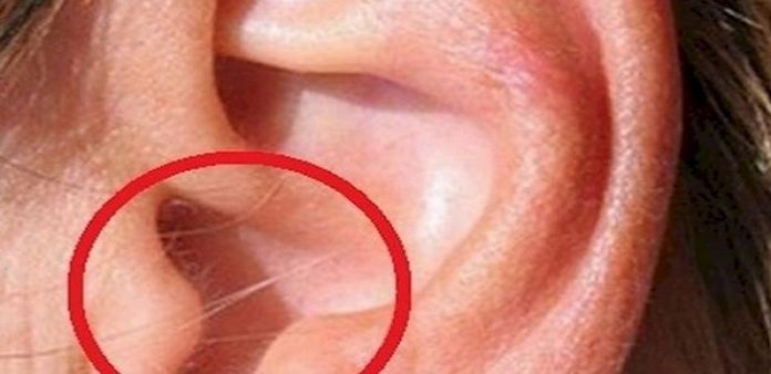 Μεγαλη μεγαλη προσοχη: Κοιταξτε τι σημαινει αν εχετε τριχοφυΐα στο συγκεκριμενο σημειο του αυτιου!
